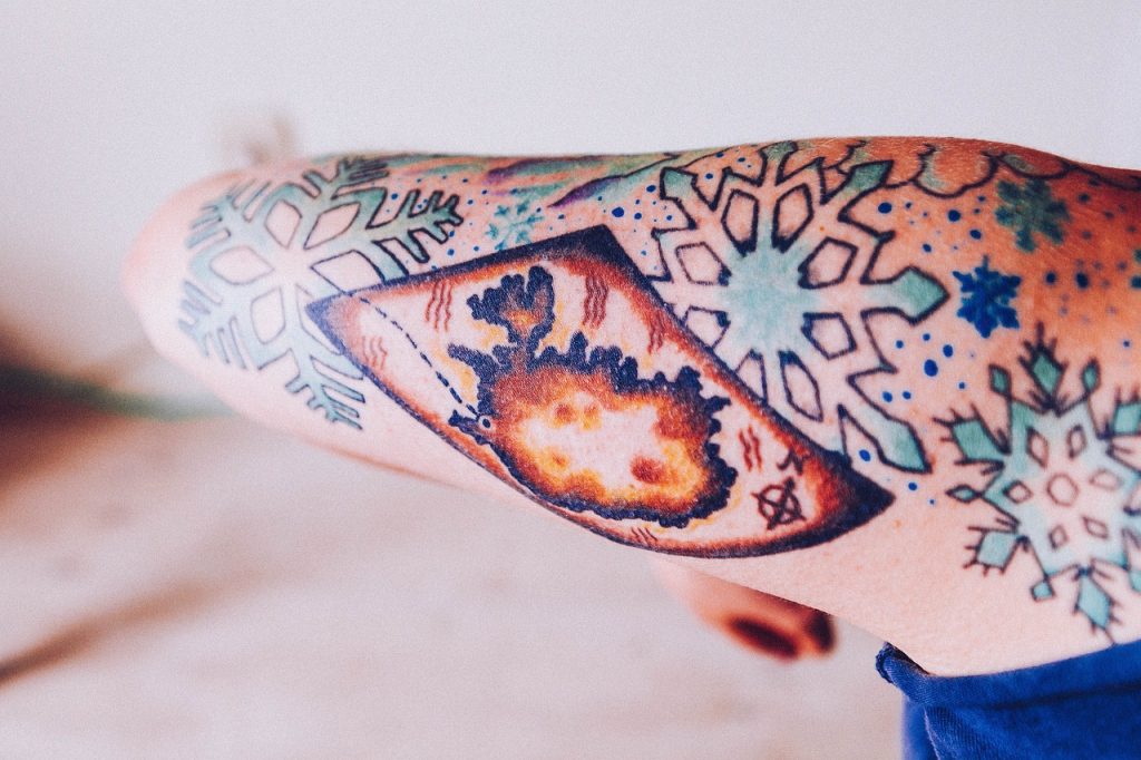 tattoo removal